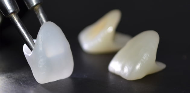 Răng sứ Cercon - Trung Tâm Phục Hình Răng Giả Công Nghệ Cao Lab Smile Gold